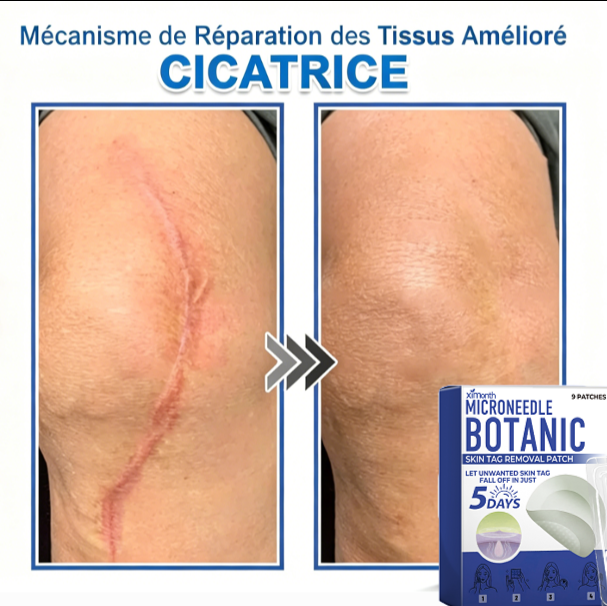 Patch hydrocolloïde à micro-aiguilles 2-en-1 pour l'élimination des grains de beauté en relief, de l'acné, des verrues planes et des acrochordons.