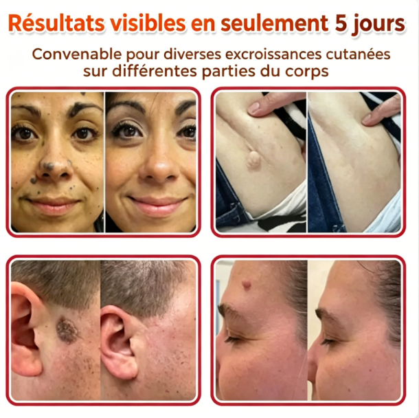 Patch de soin – Confort et Bien-être au Quotidien