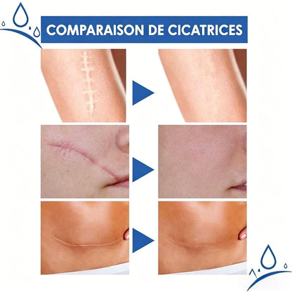 Crème Réparatrice Anti-Cicatrices
