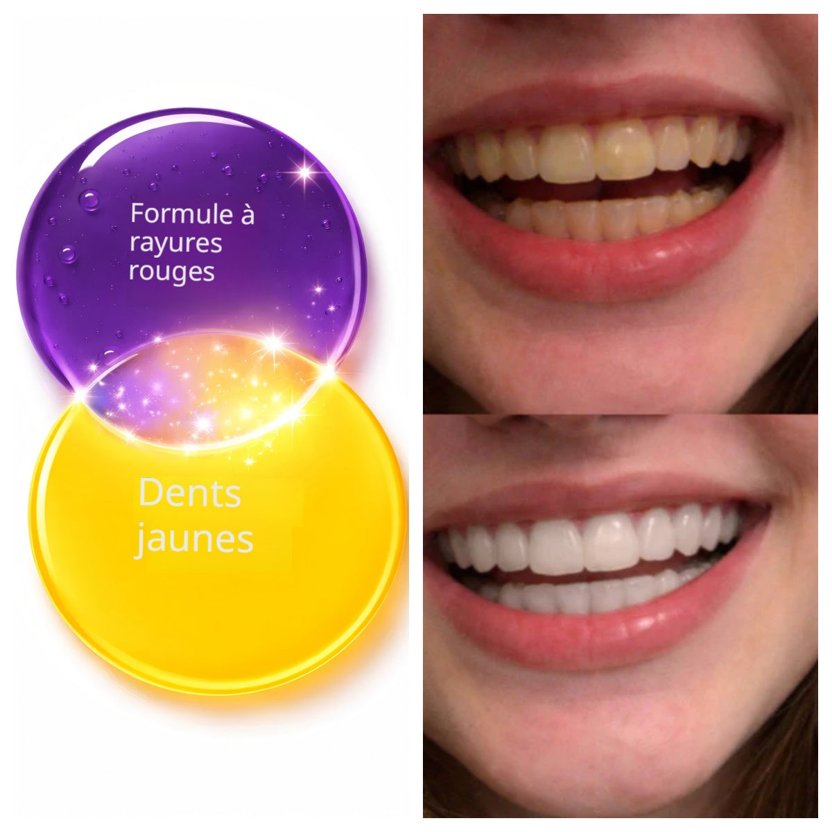 🦷 Bandes de Blanchiment Dentaire Feimuko