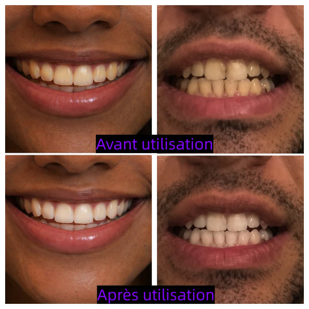 🦷 Bandes de Blanchiment Dentaire Feimuko