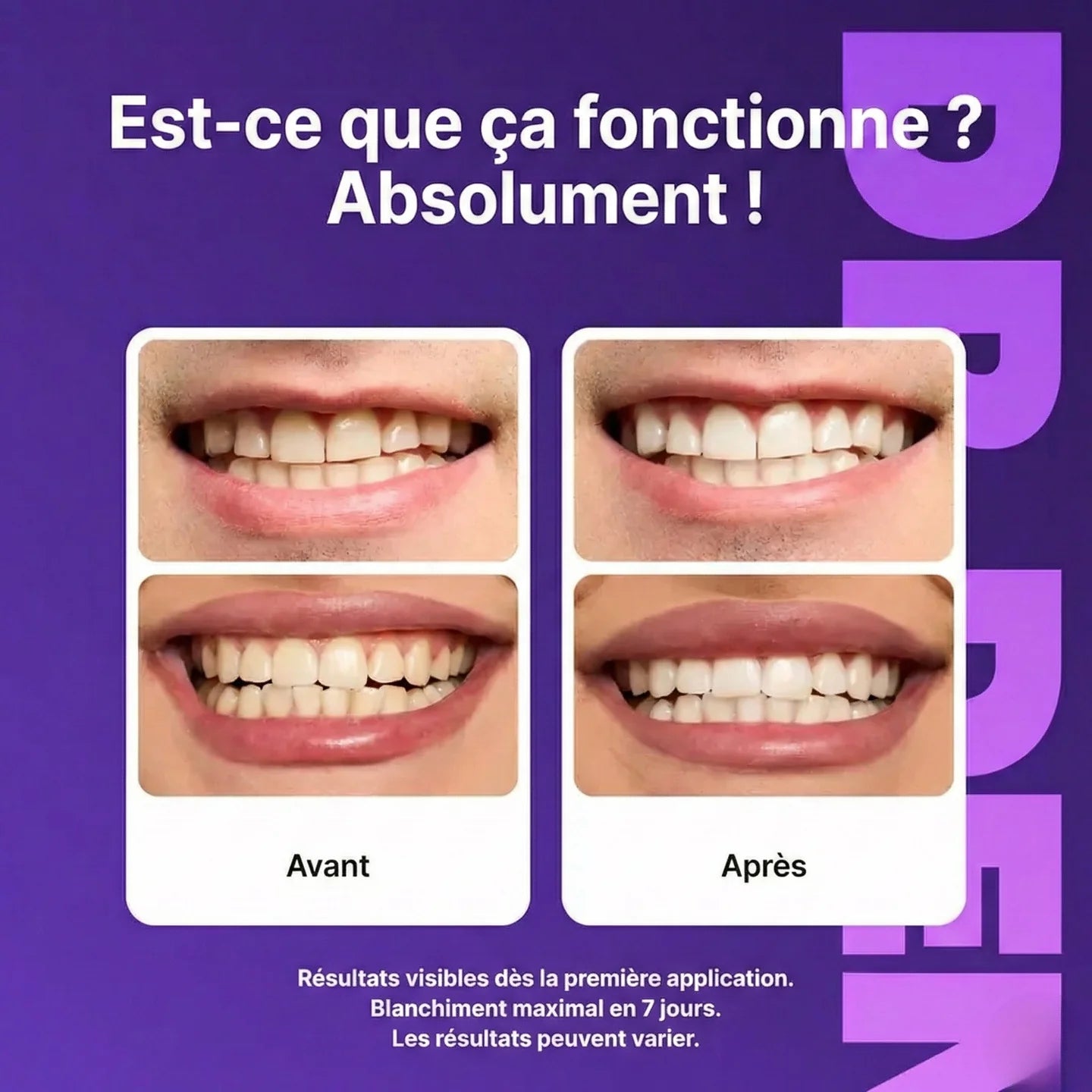 Bandes de blanchiment dentaire