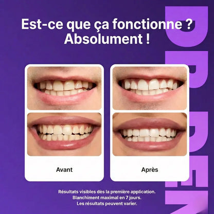 Bandes de blanchiment dentaire