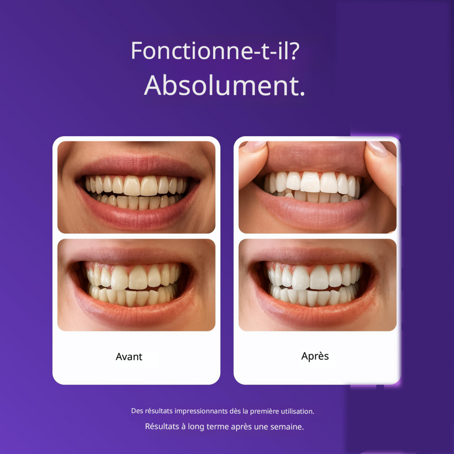 🦷 Bandes de Blanchiment Dentaire Feimuko