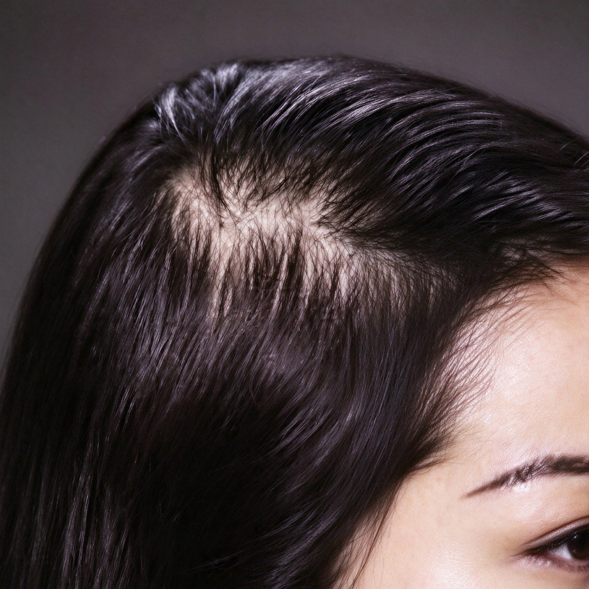 Visible scalp at a sparse hair part before cosmetic fiber application