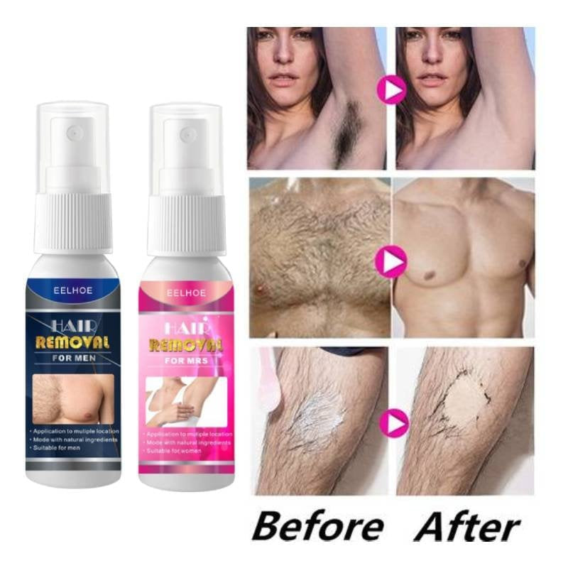 New 2026 Hair Removal Spray