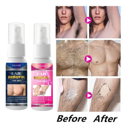 New 2026 Hair Removal Spray