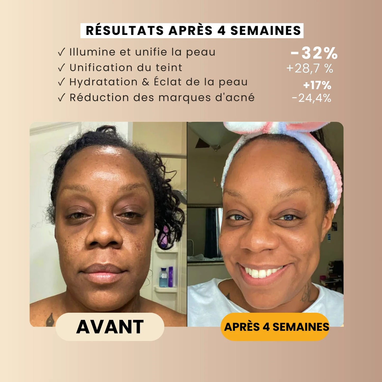 Savon Anti-Taches au Curcuma