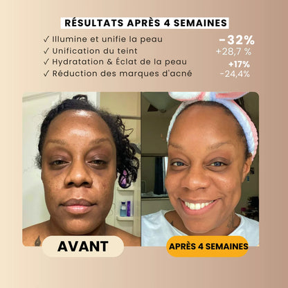 Savon Anti-Taches au Curcuma