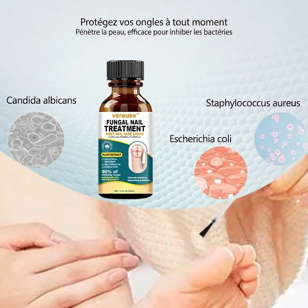 Vereuse™ Sérum réparateur pour ongles
