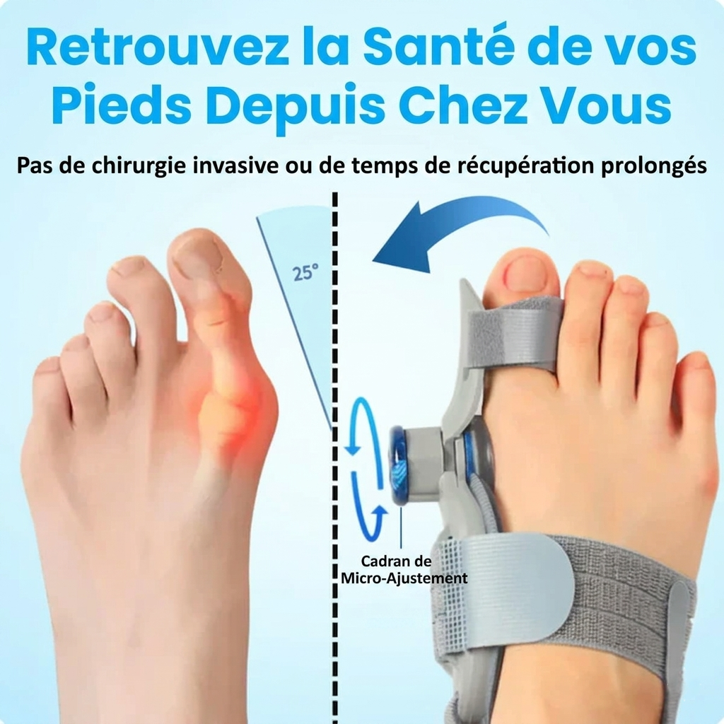 Vereuse™ – Soulagement non chirurgical de la douleur liée aux oignons