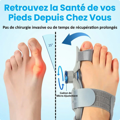 Vereuse™ – Soulagement non chirurgical de la douleur liée aux oignons