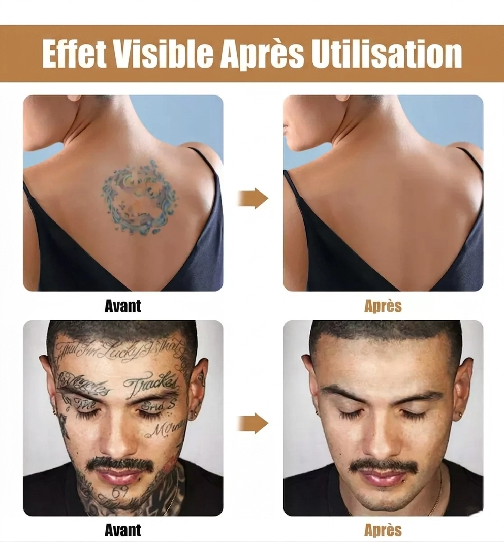 Kit Correcteur de Teint Haute Couvrance – Waterproof & Sur-Mesure Masquez tatouages