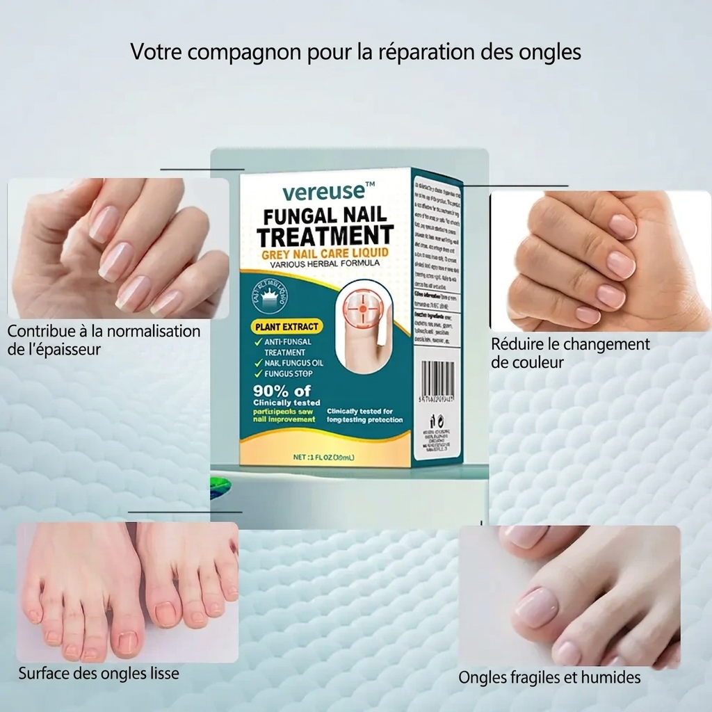 Vereuse™ Sérum réparateur pour ongles