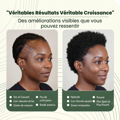 Huile naturelle de Batana pour la croissance des cheveux