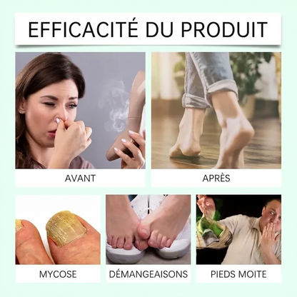 Spray Assainissant Anti-Odeurs & Anti-Fongique aux Huiles Essentielles d'Arbre à Thé (100ml)