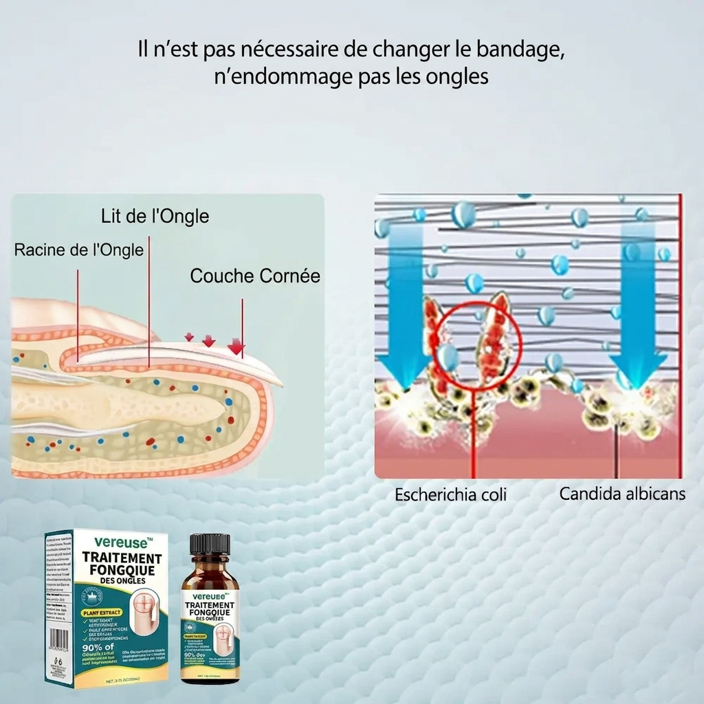 Vereuse™ Sérum réparateur pour ongles
