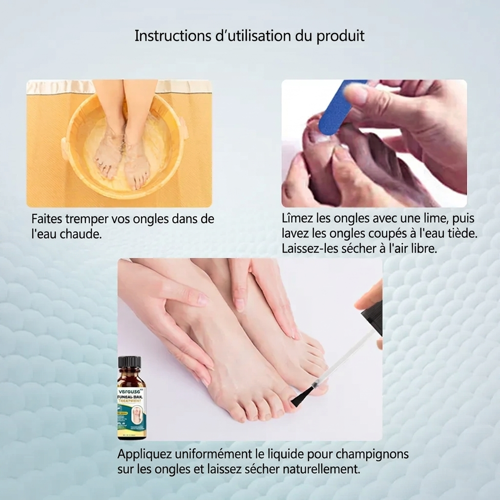 Vereuse™ Sérum réparateur pour ongles