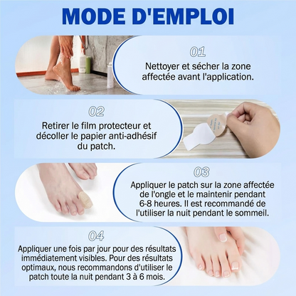 Patchs réparateurs pour ongles mycosés