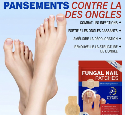 Patchs réparateurs pour ongles mycosés
