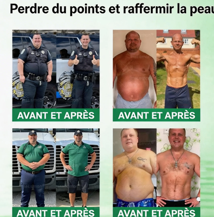 Patch amincissant à nano-aiguilles
