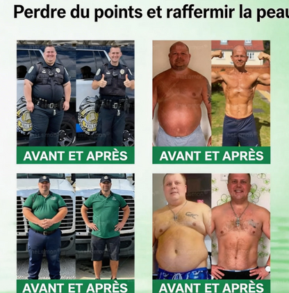 Patch amincissant à nano-aiguilles