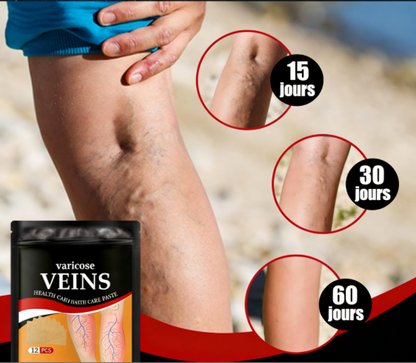 Patch pour varices | Gonflement, fatigue et Santé veineuse
