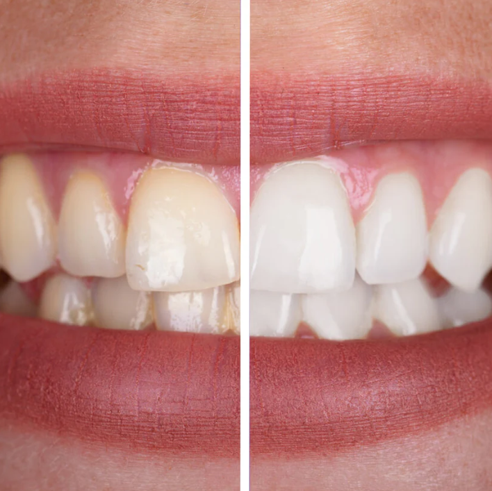 Dentifrice Violet – Soin Éclat & Blancheur Visuelle