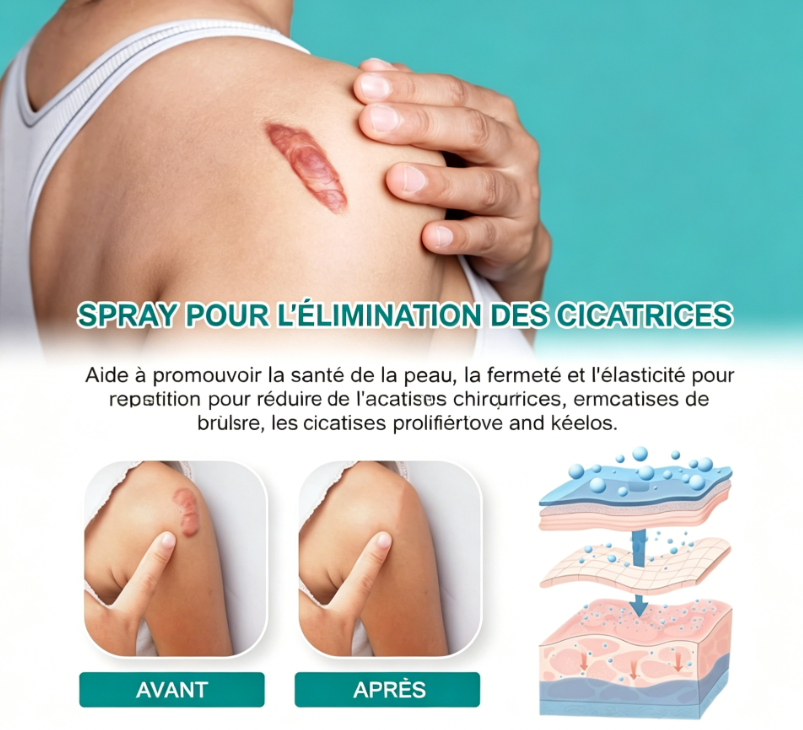 Spray pour cicatrices South Moon – Qualité premium