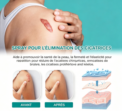 Spray pour cicatrices South Moon – Qualité premium