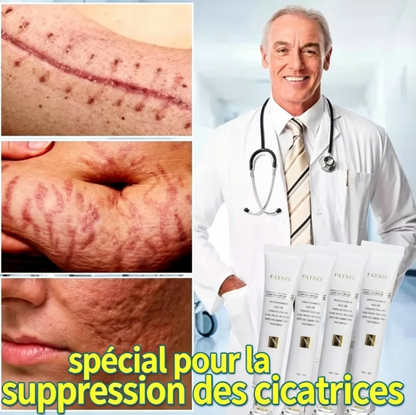 Crème FATAZEN pour l'élimination des cicatrices d'acné