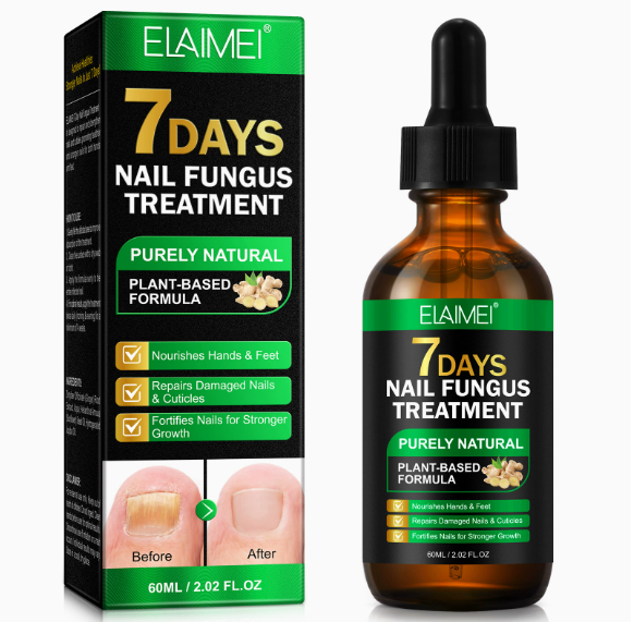Essence réparatrice pour les ongles au gingembre : Réparez vos ongles en 7 jours — Dites adieu à l'envie de les cacher