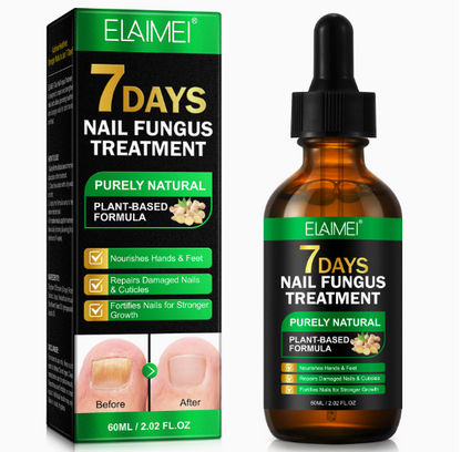 Essence réparatrice pour les ongles au gingembre : Réparez vos ongles en 7 jours — Dites adieu à l'envie de les cacher