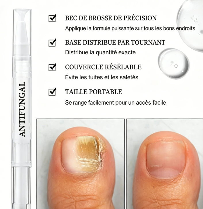 Stylo de traitement contre les mycoses des ongles — Adapté aux ongles abîmés