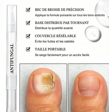 Stylo de traitement contre les mycoses des ongles — Adapté aux ongles abîmés
