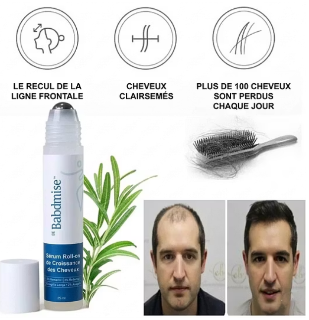 Sérum Croissance Cheveux Roll-On