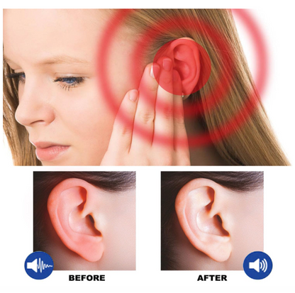 Spray pour le soulagement des acouphènes