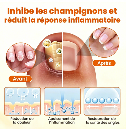 Spray réparateur pour les ongles au venin d'abeille