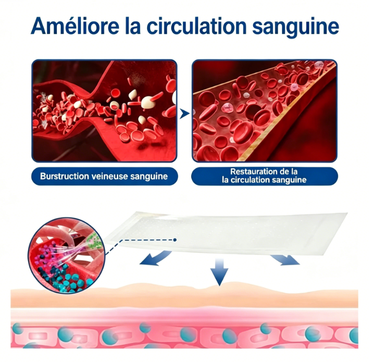 Patch de traitement des varices par micro-aiguilles