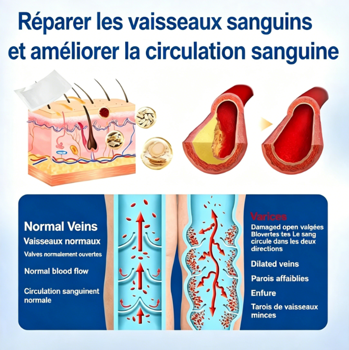 Patch de traitement des varices par micro-aiguilles