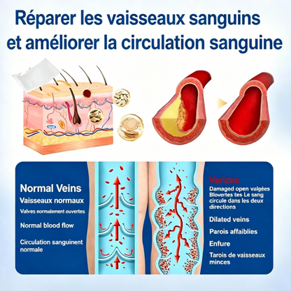 Patch de traitement des varices par micro-aiguilles
