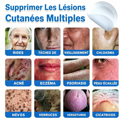 Patch hydrocolloïde à micro-aiguilles 2-en-1 pour l'élimination des grains de beauté en relief, de l'acné, des verrues planes et des acrochordons.