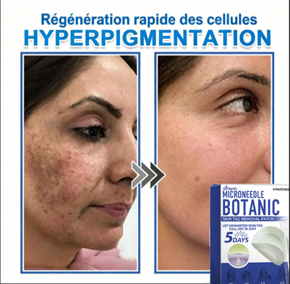 Patch hydrocolloïde à micro-aiguilles 2-en-1 pour l'élimination des grains de beauté en relief, de l'acné, des verrues planes et des acrochordons.