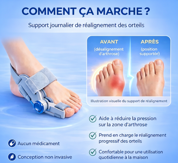 Correcteurs d'hallux valgus : soulagement non chirurgical de la douleur