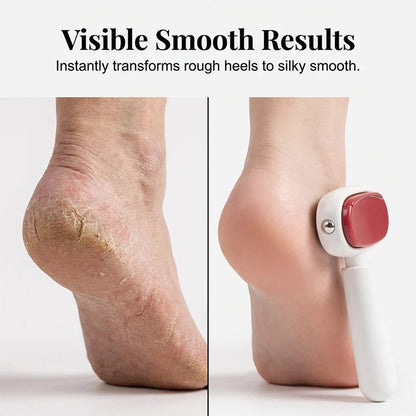 🦶✨ Dual-Sided Foot Callus Remover – Replaceable Stainless Steel Foot Scraper