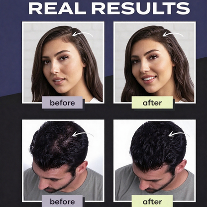 ⏳Time-Limited Special⏰-Hair Building Fibers Set for Thinning Hair & Bald Spots