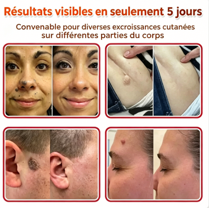 Patch de soin – Confort et Bien-être au Quotidien
